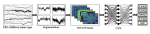 Seizure Type Classification Using EEG Based on Gramian Angular Field Transformation and Deep Learning